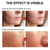 Rosarden 77% Soothing Toner, Face Toner for Women, Skin Toner, Toner for Face, Toner for Dry Skin, Refreshing, Exfoliating, Purifying, Cruelty Free